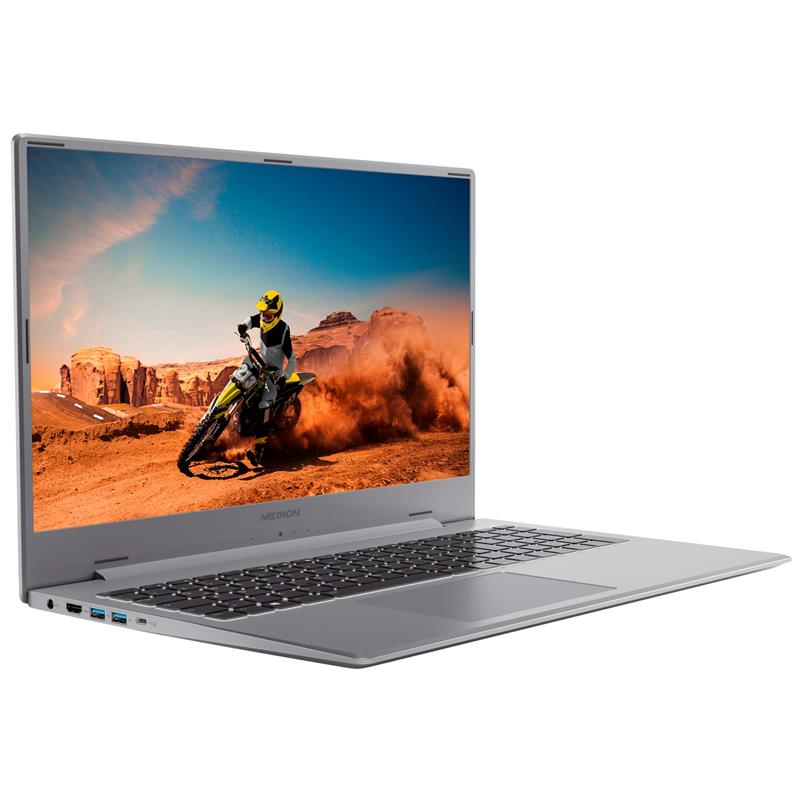 MEDION AKOYA S17413 - Laptop - Windows 11 Home - 17.3 Inch